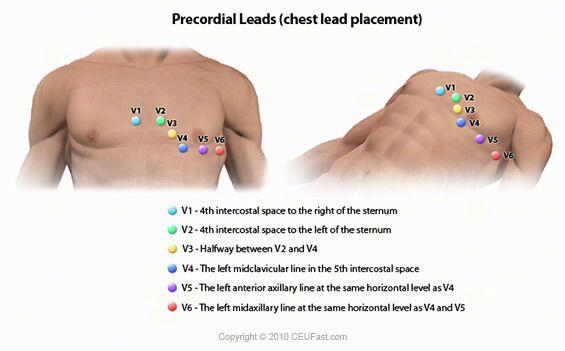 precordial leads