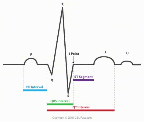 Standard Electrocardiogram Waveform Diagram