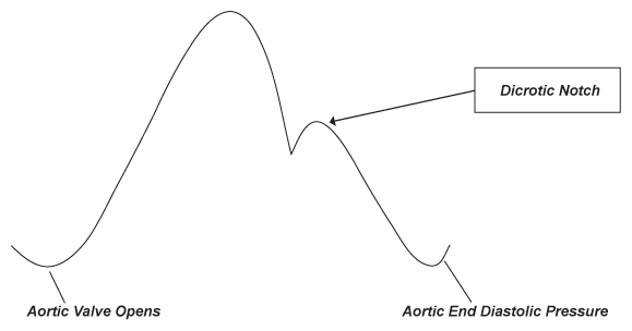 Normal Arterial Waveform