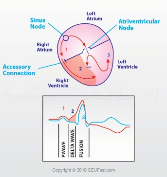 Electrical Conduction Chain of Events