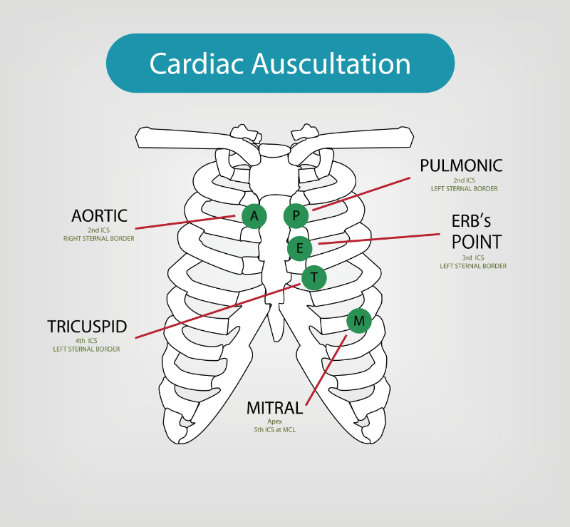 graphic showing cardiac auscultation