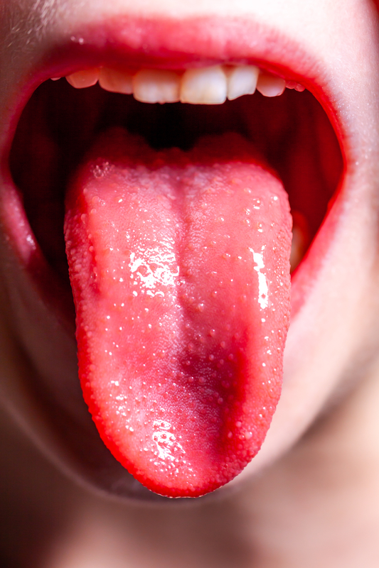 Strawberry Tongue