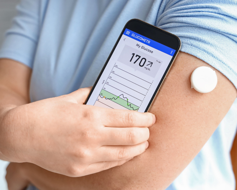 photo of glucose management technology