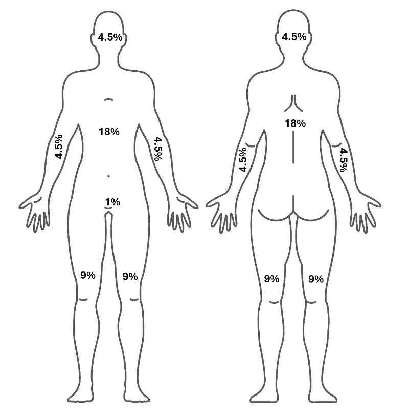graphic showing rule of nines