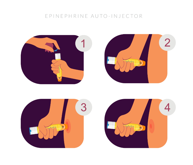 graphic showing how to use epinephrine auto injector