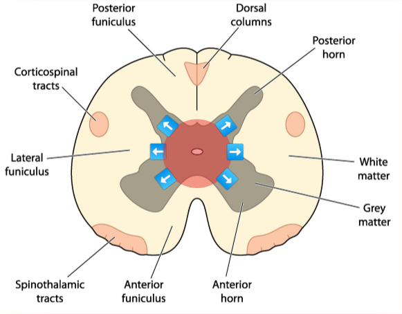 graphic showing location of lesion in central cord syndrome