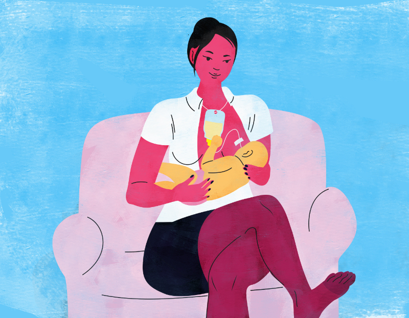 graphic showing supplemental nursing system