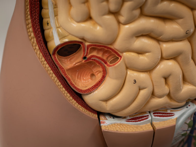 graphic showing cecum