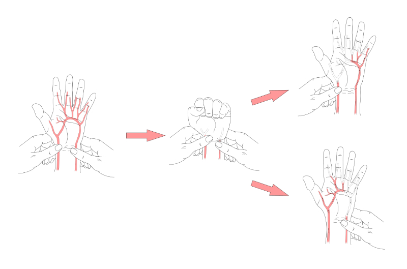 graphic showing modified allen test