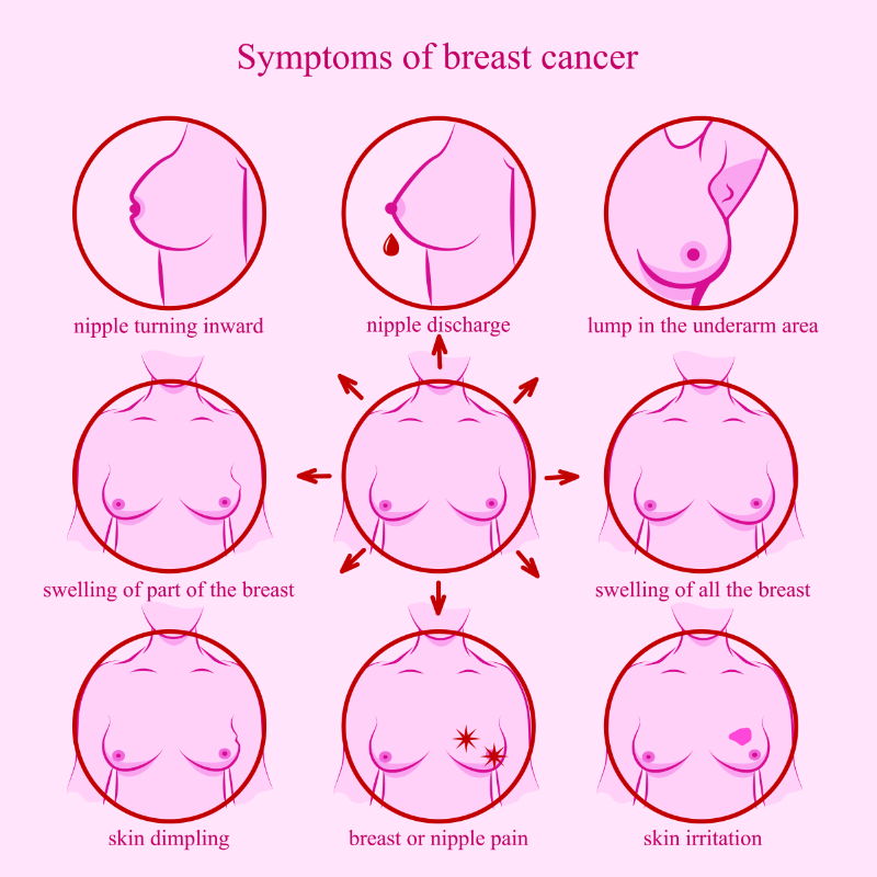 graphic showing symptoms of breast cancer