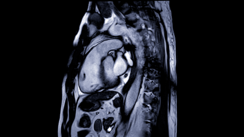 photo of cardiac mri