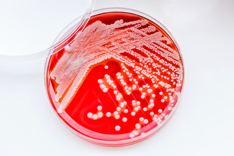 photo of staphylococcus Aureus in petri dish