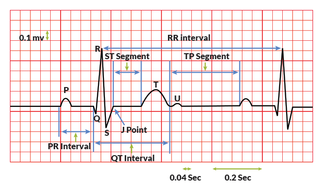electrocardiography_components