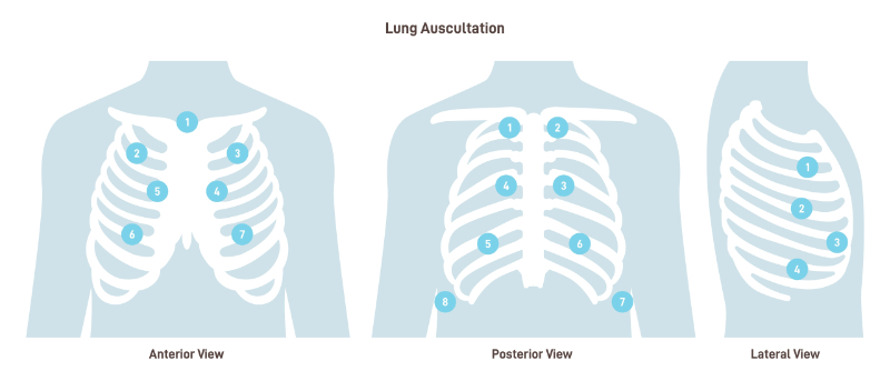 graphic showing lung auscultation