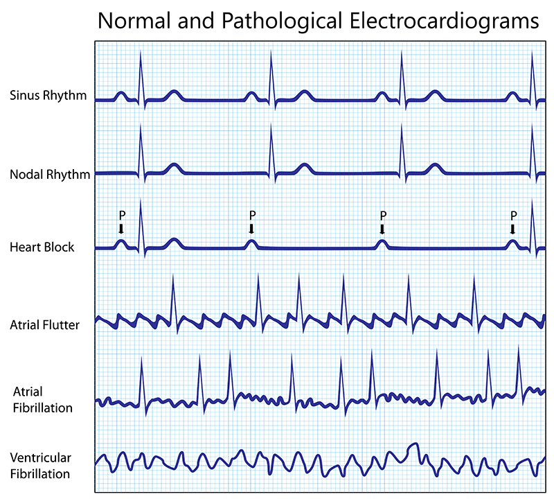 Normal and Pathological