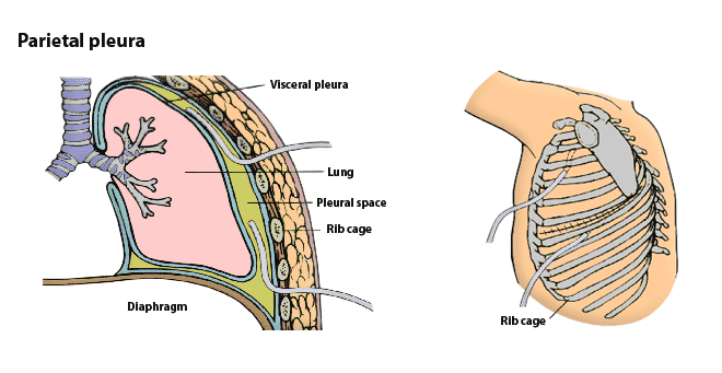 Parietal Pleura