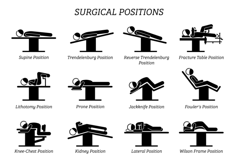 graphic showing different surgical positions