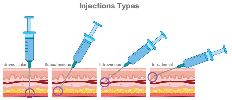 graphic showing types of injections