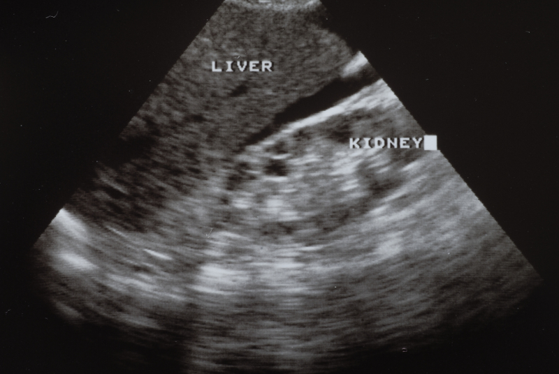ultrasound
