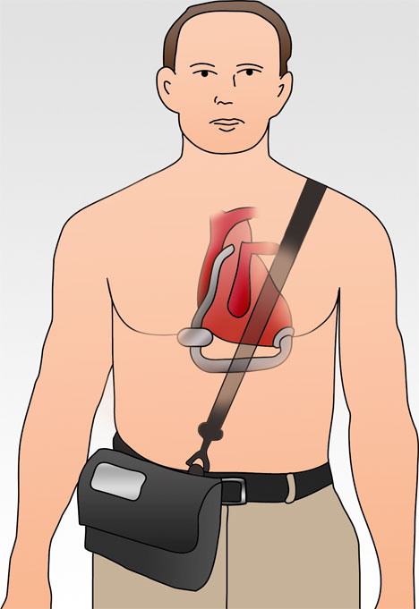 VAD 2 (drawing compliments of NASA)